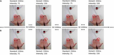 Different Patterns of Attention Modulation in Early N140 and Late P300 sERPs Following Ipsilateral vs. Contralateral Stimulation at the Fingers and Cheeks